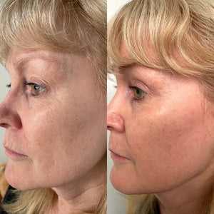 Serum of plenty Eco sonja